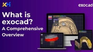 exocad 3.2