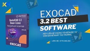 exocad 3.2